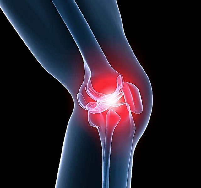 Arthrose fhrt zu Schmerzen im Kniegelenk.  | Foto: fotolia.com/sebastian kaulitzki
