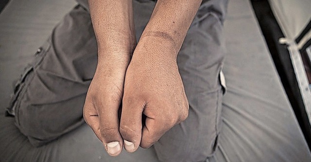 Fesselungsspuren an Handgelenken: Pro ...nach Syrien als vlkerrechtswidrig an.  | Foto: dpa