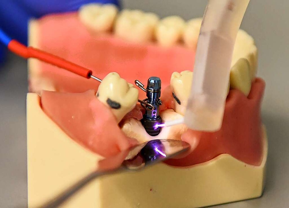 Ein Zahn-Implantat wird mit einem Plasmastrahl desinfiziert.  | Foto: Rita Eggstein