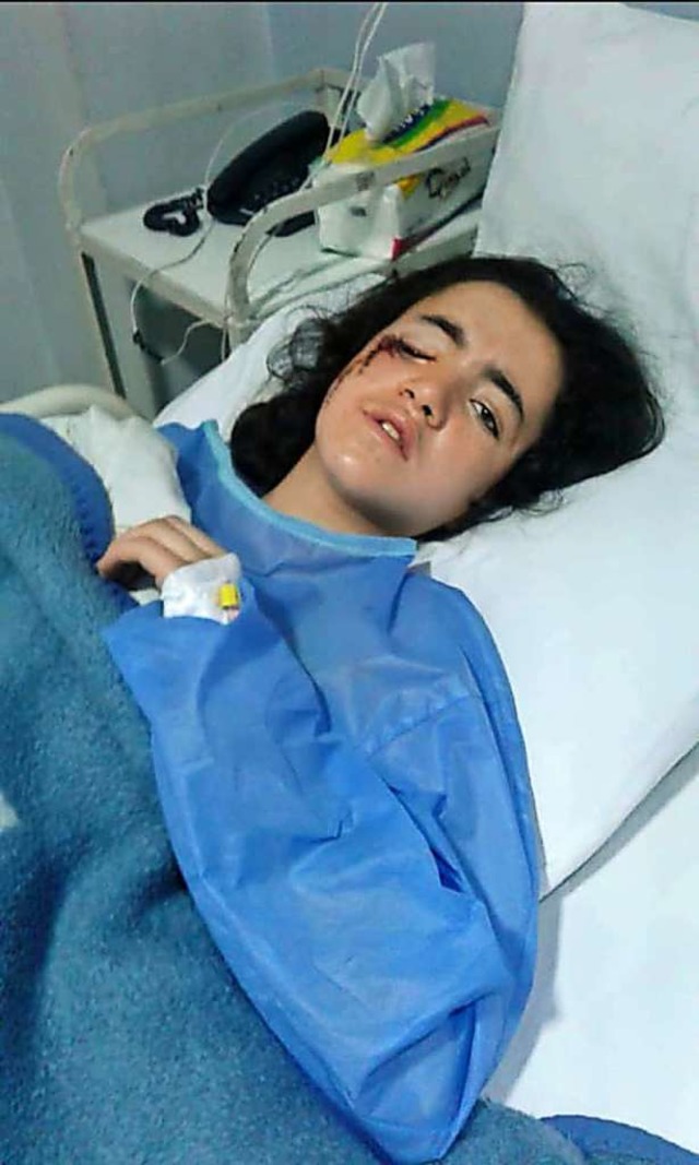Alia liegt nach der Operation im Krank...r aufwendige Eingriff war erfolgreich.  | Foto: privat