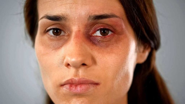 Misshandelten Frauen ausreichend Schut...helfen Frauen in Lrrach (Symbolfoto).  | Foto: motortion  (stock.adobe.com)