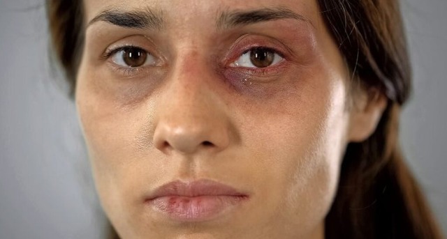 Misshandelten Frauen ausreichend Schut...helfen Frauen in Lrrach (Symbolfoto).  | Foto: motortion - stock.adobe.com