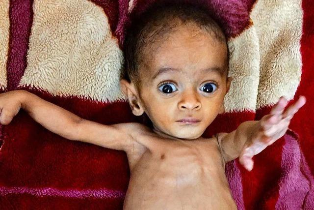 Vergessen von der Welt: Der Jemen ist von Krieg und Hunger zermürbt