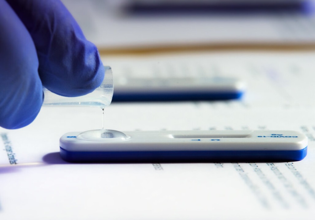 Auswertung eines Corona-Schnelltests.  | Foto: Soeren Stache (dpa)