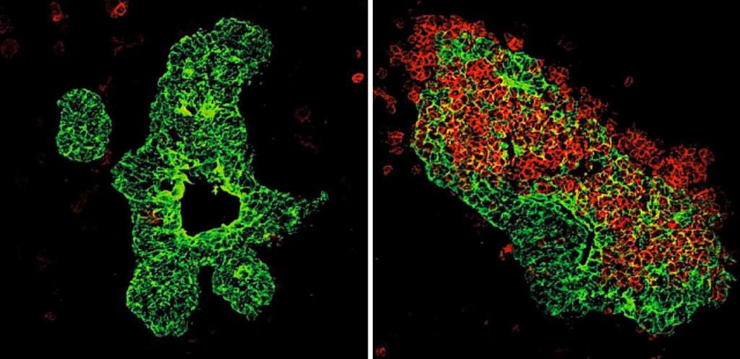 Angefärbte Thymuszellen,  wie sie sich unter dem Mikroskop zeigen  | Foto: BZ