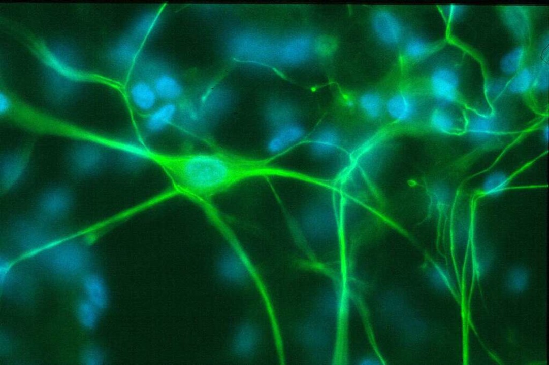 Eine Nervenzelle und ihre Verbindungen  | Foto: BZ