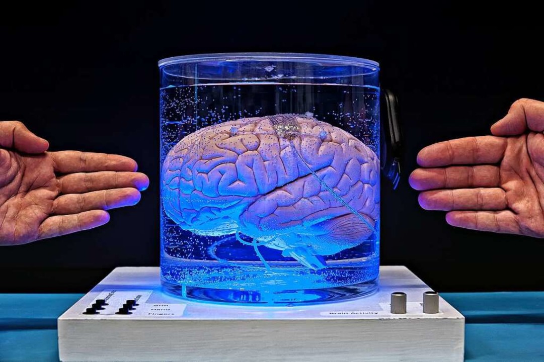 Modell eines Gehirns mit Hirnimplantat.  | Foto: Jessen Oestergaard / Daimler-und-Benz-Stiftung