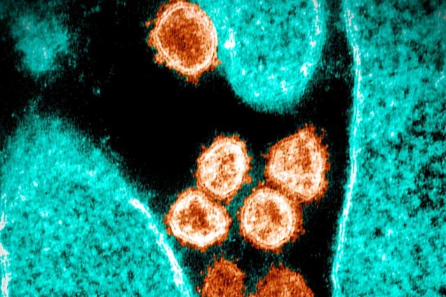 Coronaviren (Orange) beim Verlassen einer Zelle unte dem Elektronenmikroskop.  | Foto: HANDOUT (AFP)