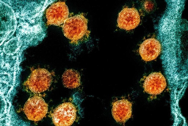 Coronaviren unter dem Elektronenmikroskop  | Foto: Uncredited (dpa)