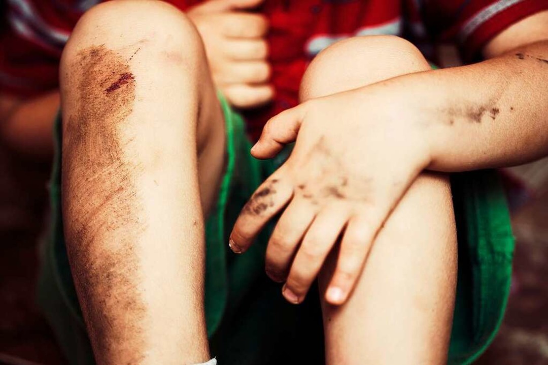 Eine der häufigsten Kinderverletzungen: aufgeschürftes Knie  | Foto: Travel_Master  (stock.adobe.com)