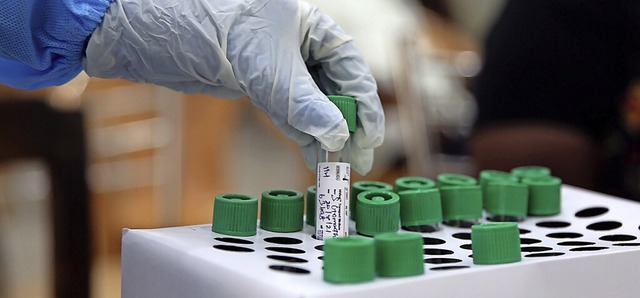 PCR-Tests sind aufwendig und teuer. Do...age danach knnte  schon bald steigen.  | Foto: Sri Loganathan (dpa)