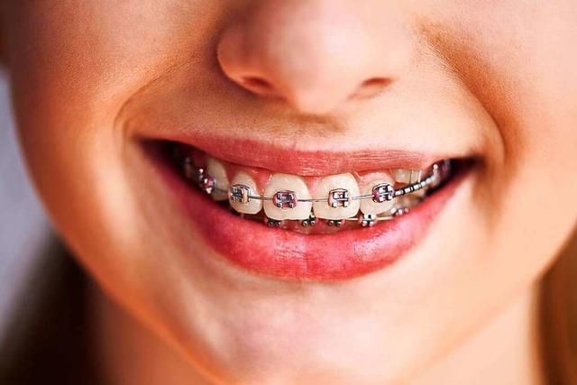 Zahnspangen bei Kindern haben meist keine medizinischen Gründe