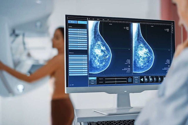Technik und Gerte bei der Mammographi...eren Frauen zu entdecken (Symbolbild).  | Foto: Gorodenkoff Productions OU (Adobe Stock)