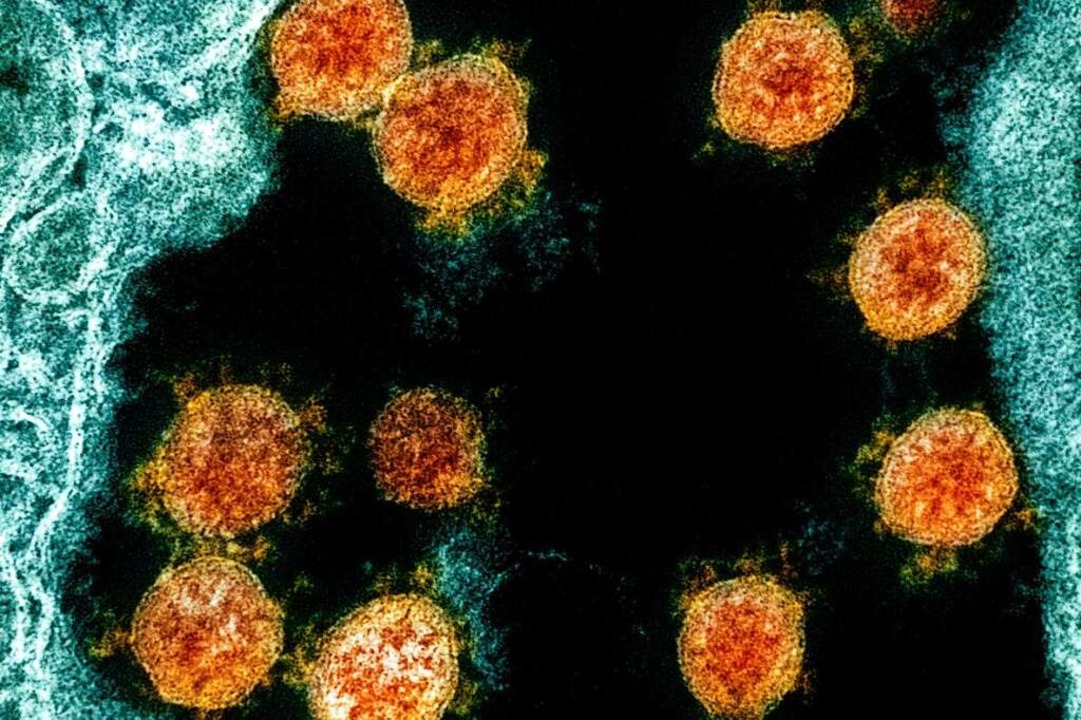 Partikel des Coronavirus SARS-CoV-2, (... wurden. (Aufnahme aus dem Jahr 2020).  | Foto: Uncredited (dpa)