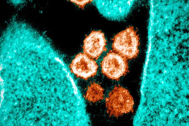 Coronaviren unter dem Elektronenmikroskop (Archivbild).  | Foto: HANDOUT (AFP)