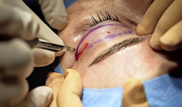 Ein plastischer Chirurg fhrt eine Lidstraffung durch.  | Foto: Uwe Anspach (dpa)
