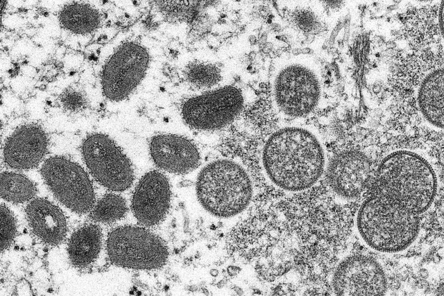 Mikroskopische Aufnahme des Virus  | Foto: Cynthia S. Goldsmith (dpa)
