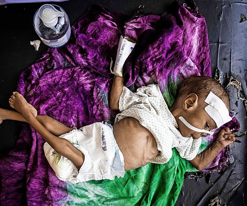 Die Ernährungssituation am Horn von Af...higend&#8220;, so die Welthungerhilfe.  | Foto: ED RAM (AFP)