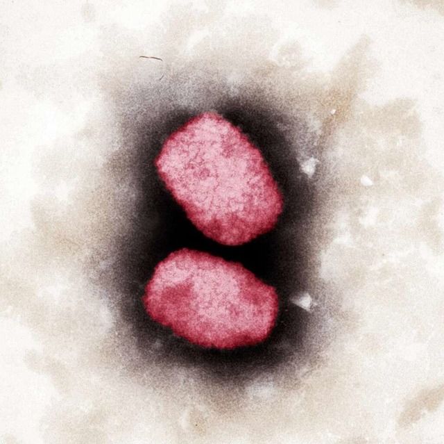 Affenpocken-Viren unterm Elektronenmikroskop.  | Foto: Andrea Mnnel (dpa)