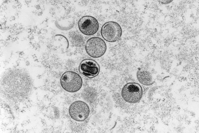 Elektronenmikroskopische Aufnahme von Affenpocken-Viren  | Foto: Freya Kaulbars (dpa)