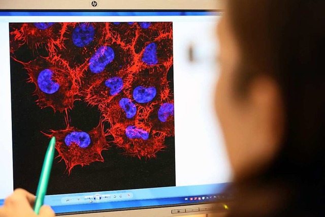 Schwarzer Hautkrebs, dargestellt auf einem Computerbildschirm  | Foto: Bernd Wstneck