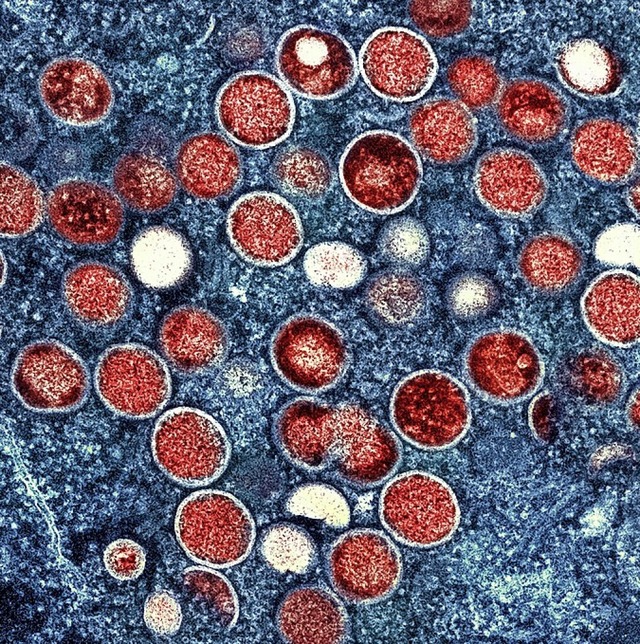 Affenpockenviren unter dem Elektronenmikroskop  | Foto: Niaid, Niaid (dpa)