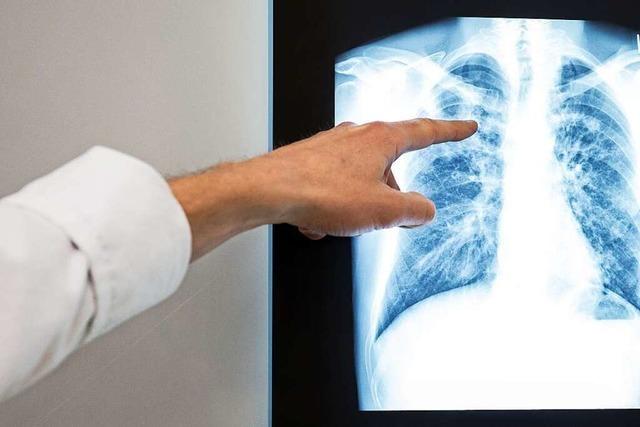 In Baden-Württemberg sinkt die Zahl der Tuberkulose-Fälle leicht