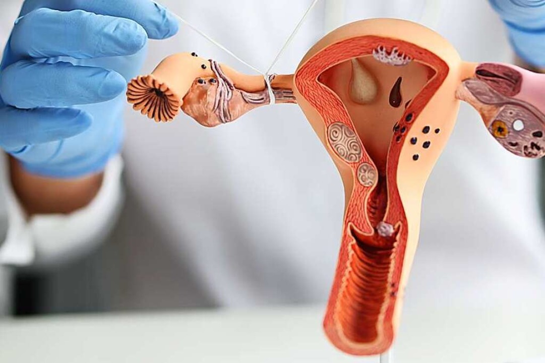 Bei einer Sterilisation bei einer Frau... Eileiter durchtrennt oder abgebunden.  | Foto: megaflopp (stock.adobe.com)