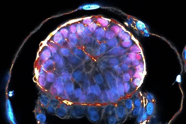 Wissenschaftler entwickeln künstliche Embryoiden aus Stammzellen