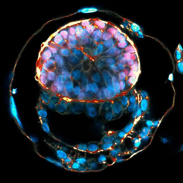 Das Bild zeigt einen synthetischen hum...s den Zellen, die die Plazenta bilden.  | Foto: Jacob Hanna - Weizmann Institute od Science