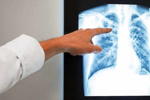Tuberkulose ist derzeit das wichtigste Thema im Ortenauer Gesundheitsamt – und nicht Corona