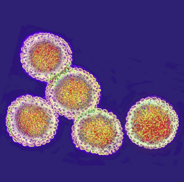 Influenzavirus unterm Mikroskop  | Foto: IMAGO/CAVALLINI JAMES / BSIP