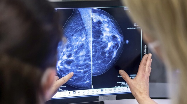 Mit einer Mammographie kann  Brustkrebs  entdeckt werden.  | Foto: Hannibal Hanschke (dpa)