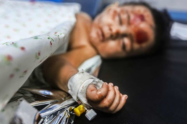 Ein Kind im Al-Shifa-Krankenhaus in Gaza   | Foto: Mohammed Talatene (dpa)