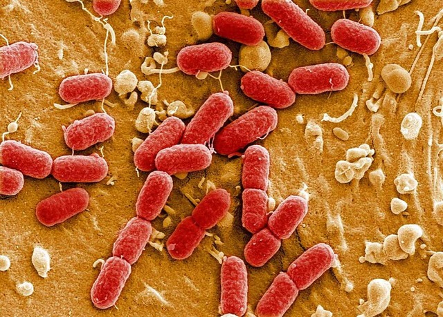 Coliforme Bakterien.  | Foto: Manfred Rohde, HZI