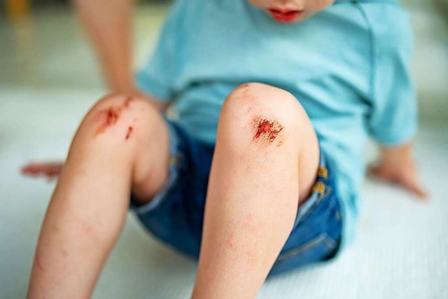 Gestolpert, Knie aufgeschrft &#8211; ...Die Ersthelfer wissen, was zu tun ist.  | Foto: MNStudio  (stock.adobe.com)