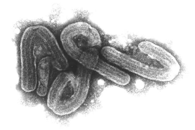 Tansania rumt Todesfall durch Marburg-Virus ein