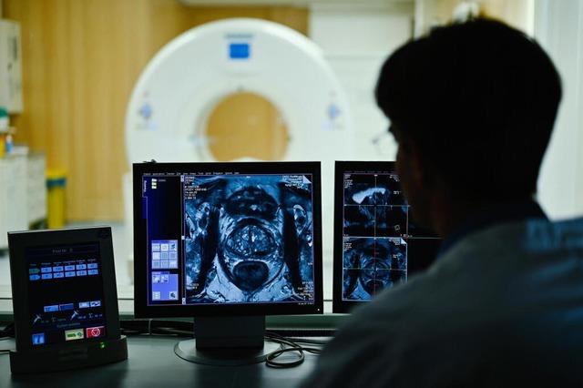 Prostatakrebs: Was Mnner wissen sollten