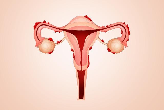 Diese Merzhauserin erhlt rund eine Million Euro fr ihre Forschung zu Endometriose in Partnerschaften