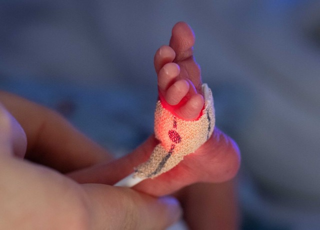 Vorsichtig berprft eine Krankenschwe...ines erst wenige Tage alten Frhchens.  | Foto: Boris Roessler (dpa)