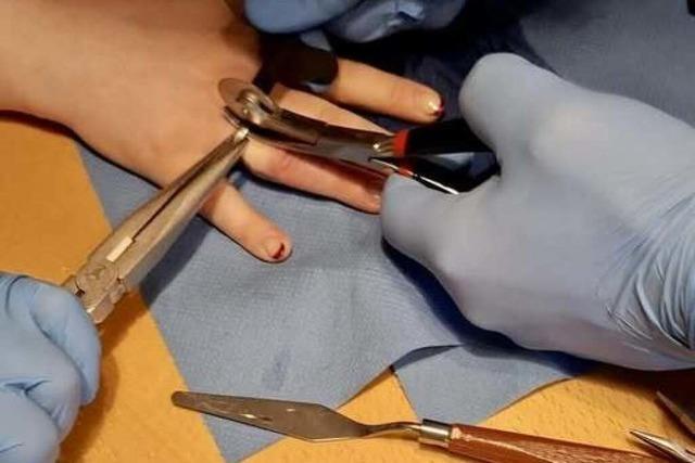 Geschwollene Hand, Probleme mit dem Ring? Kein Problem f�r die L�rracher Feuerwehr